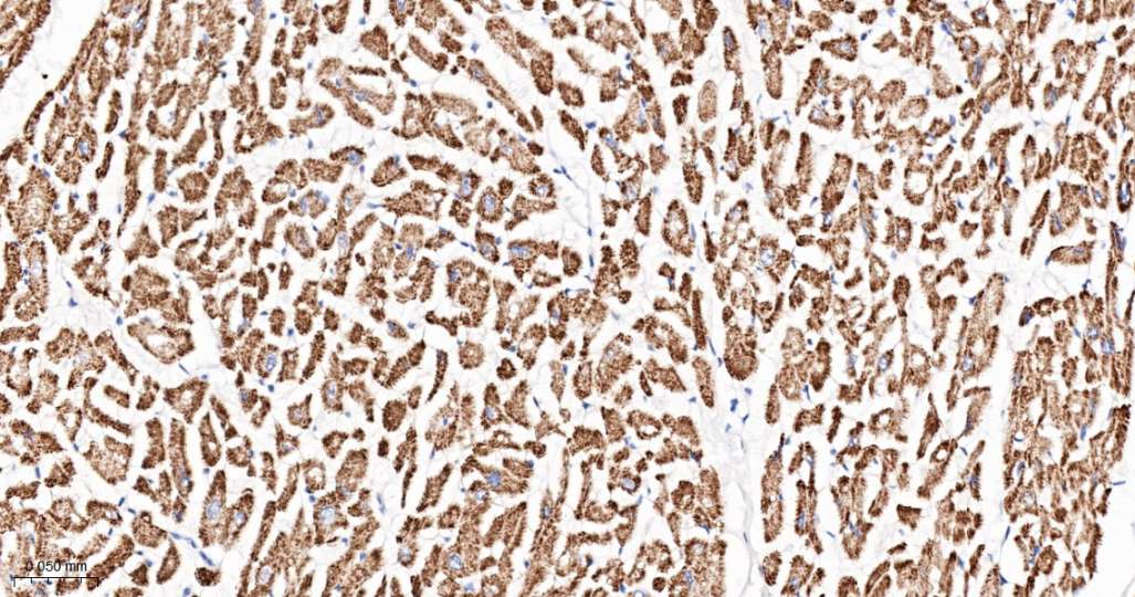 Human PDK2 Ready-To-Use IHC Kit (免疫组化试剂盒) - IHC-P | Bioss